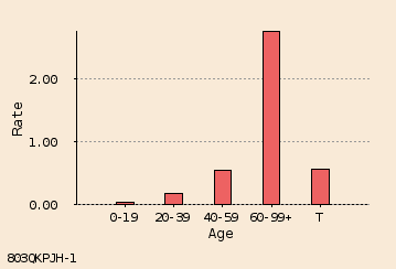 bar chart