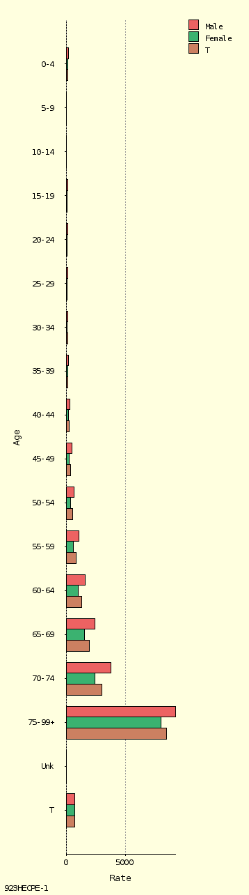 bar chart