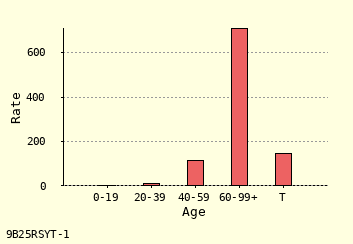 bar chart